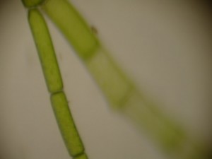Algae Seen Through Microscope